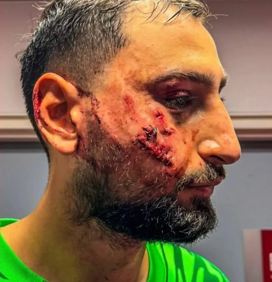 donnarumma