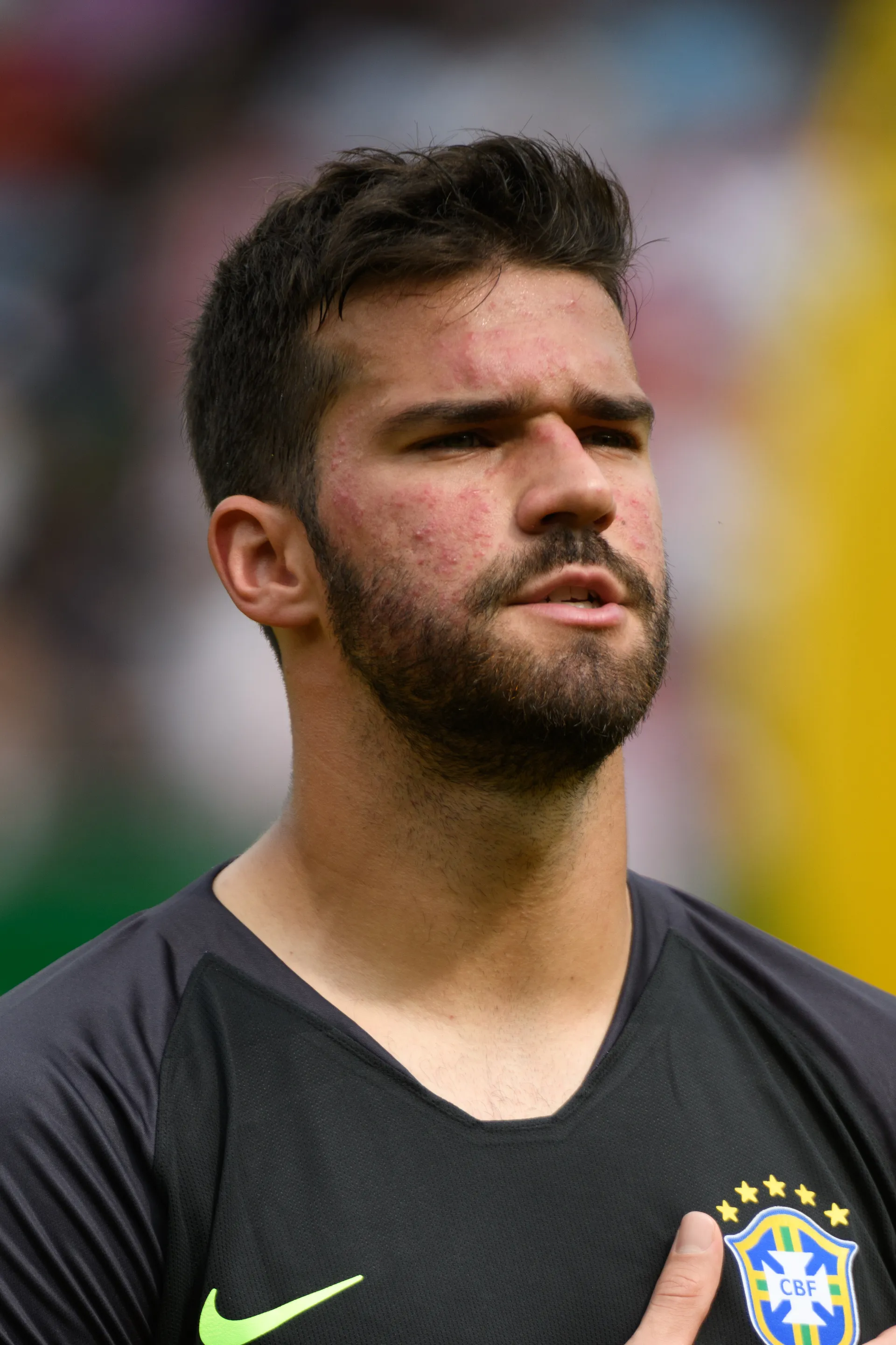 ALISSON: il balletto dei portieri di mezza Europa tiene in ansia il popolo romanista