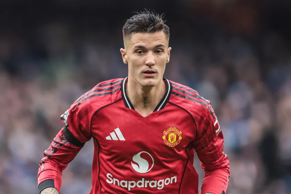 Manchester United, Amorim: “Šeško fuori qualche settimana, non è grave”